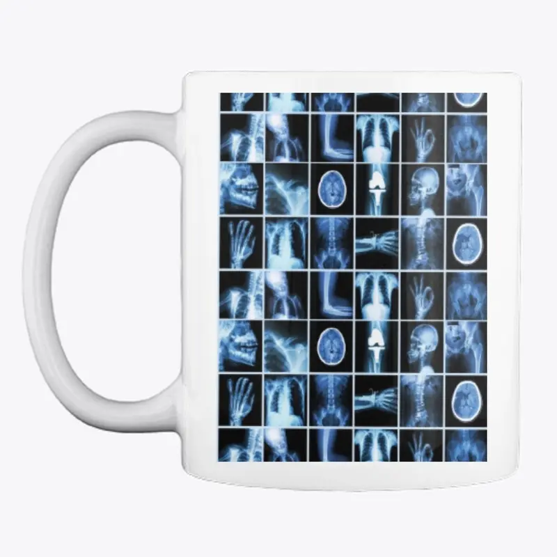 Radiology images phone cases