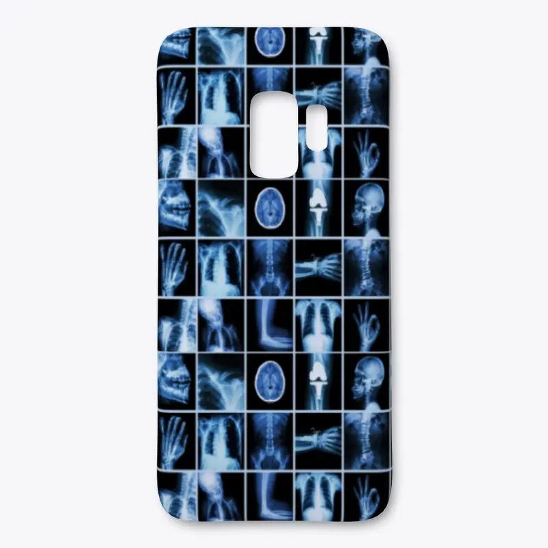 Radiology images phone cases