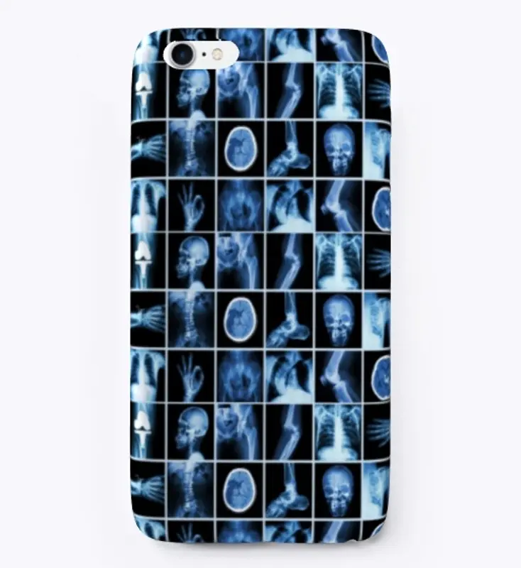 Radiology images phone cases